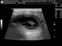 Der C-Wurf ist auf dem Weg