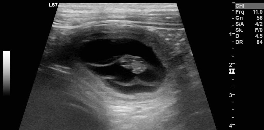 Der C-Wurf ist auf dem Weg