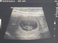 Ultraschall Termin für den D-Wurf